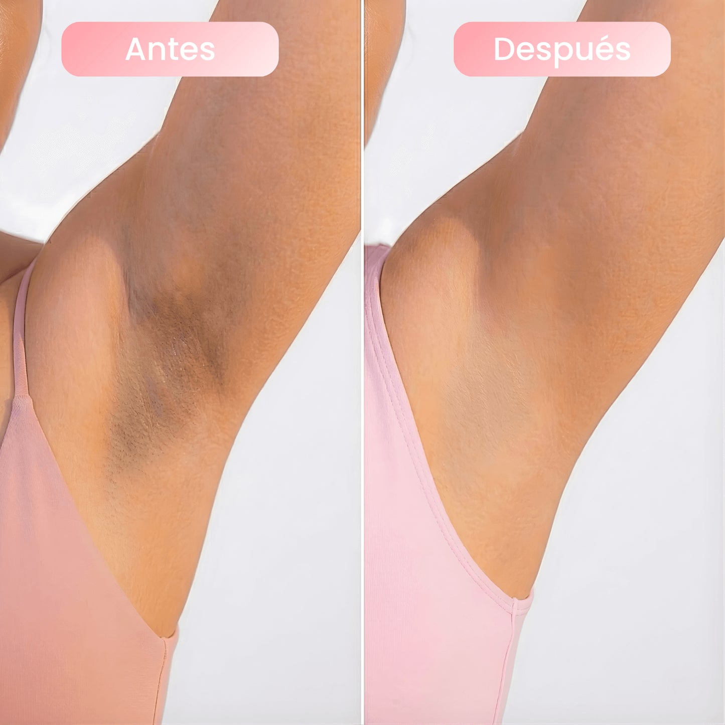 SkinTura | Spray aclarante para zonas oscuras